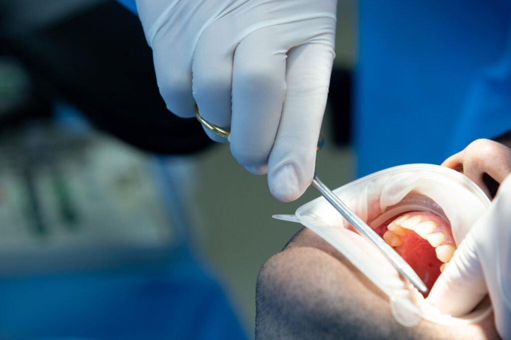 root canal treatment